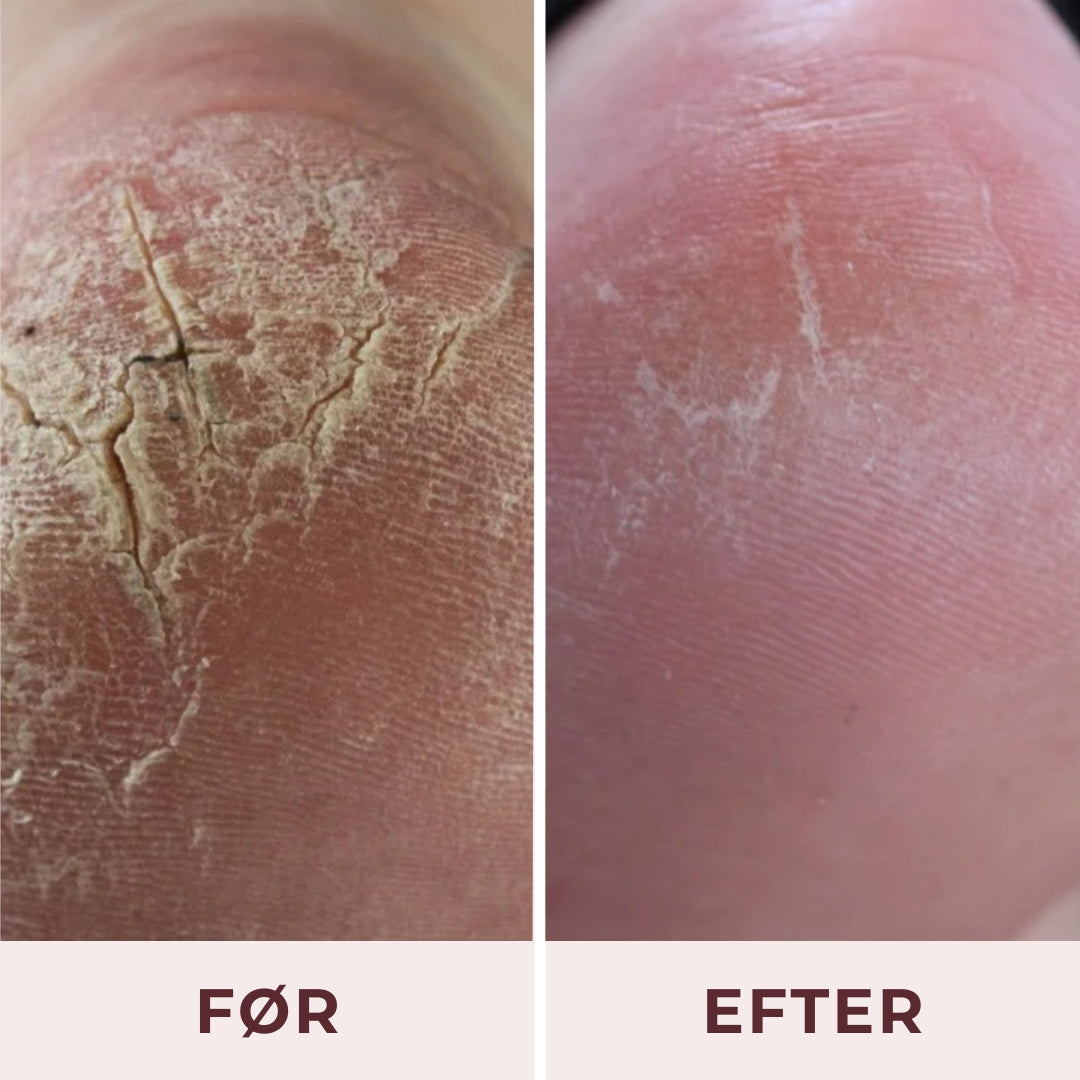 Pudderdåserne Alt i en fodcreme 100 ml