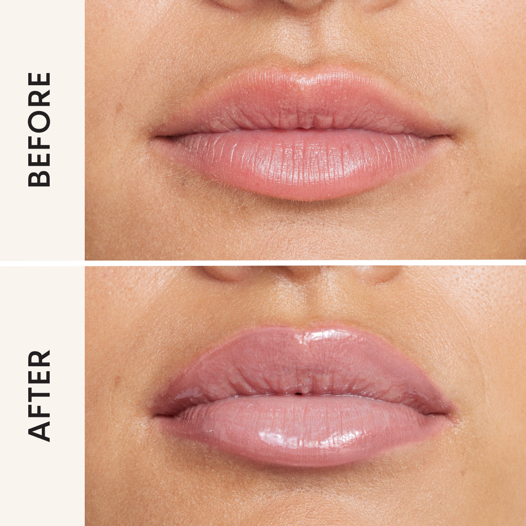 Lip Filler -  002 Ice