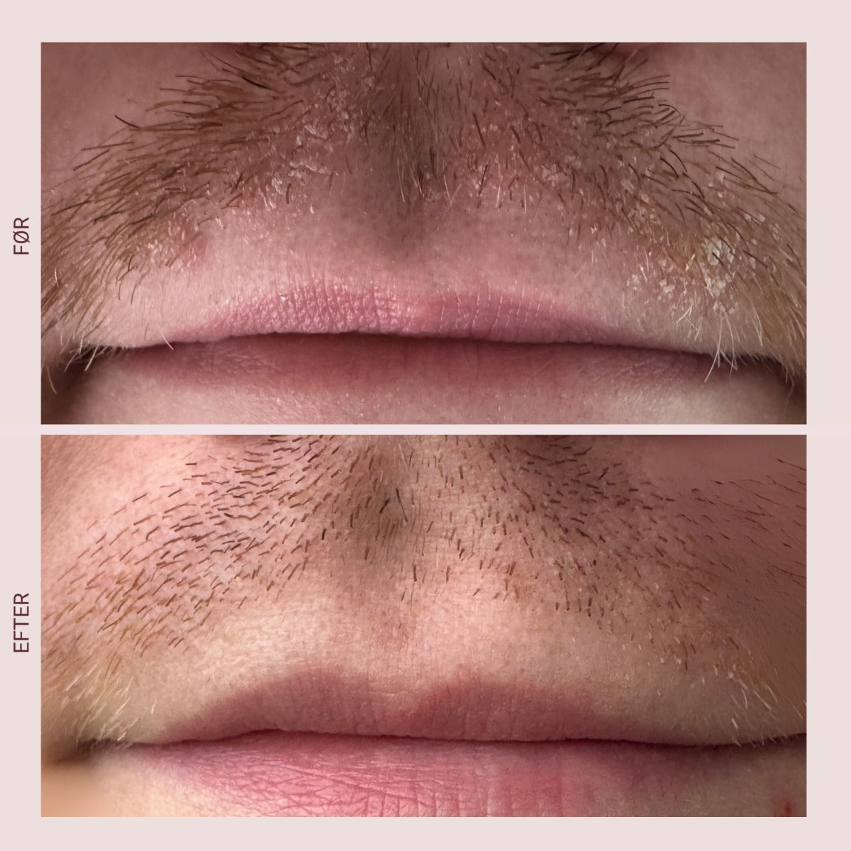 Skælserum 50 ml